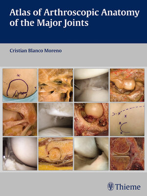 cover image of Atlas of Arthroscopic Anatomy of the Major Joints